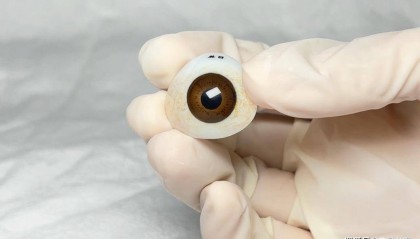 你知道做一个义眼片要多久吗?