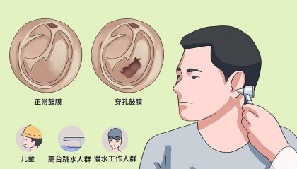 挖耳朵时有多少人担心“挖破鼓膜”？你会怎么预防？