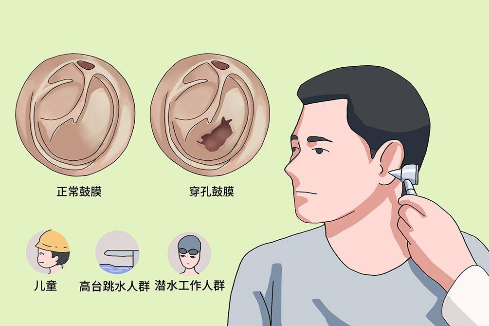 挖耳朵时有多少人担心“挖破鼓膜”？你会怎么预防？