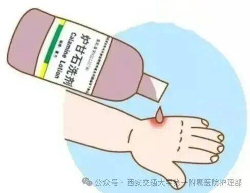 西安多区发现隐翅虫？千万别拍！毒液堪比硫酸