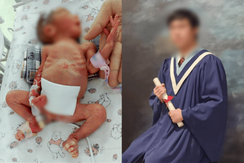 广州865克超早产儿18岁了，被海外大学录取，回医院报喜